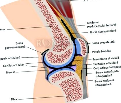 A térd laterális meniszkuszának törése, Meniszkusz sérülése (Porcleválás)
