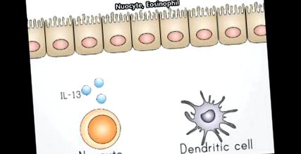 Galandféreg-fertőzés - Helminth fertőzések elleni antitestek