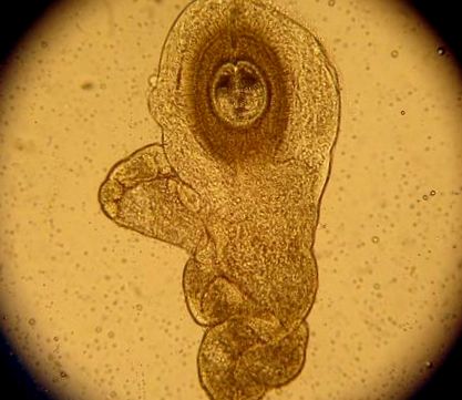 helminth féreg mérete calamus gyökerek parazitáktól