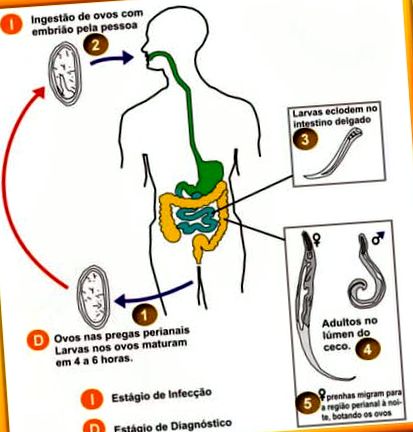 hogyan fordul elő pinworms