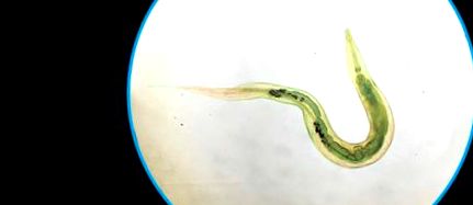 A pinworms és a roundworms különbsége