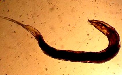 cérnagiliszta ellen házilag trichocephalus morfológia