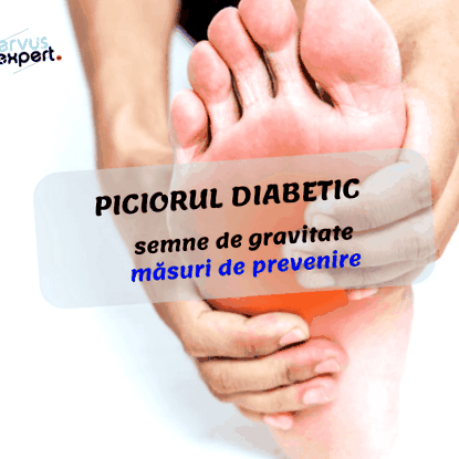hideg lábápolás diabetes sült íj kezelés cukorbetegséggel