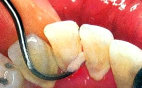 ústnej dutiny