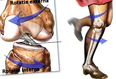 térdízület artrózisa 1 fokos előrejelzés fájdalom a térdízületben mit kell tenni hogyan kell kezelni