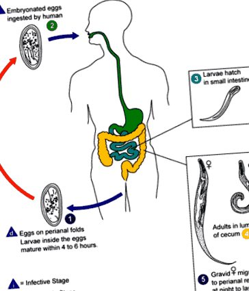 pinwormot fedezett fel a giardiasis lokalizációja a testben