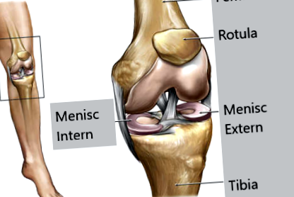 A térdízület meniszkuszának hátsó szarvának károsodása - A térd deformáló artrózisa 2 fokos kezelés