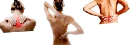 Amitől a gerinc fájhat 2. – csigolya elcsúszás – spondylolisthesis