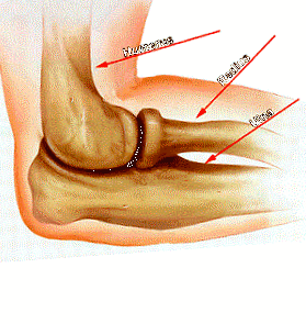 komplex az osteochondrosis számára a lábujjak deformációja artritiszben