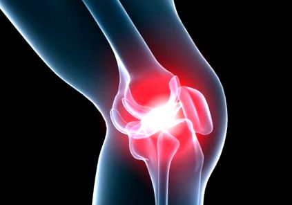 a boka előkészítésének deformáló artrózisa kezelésre