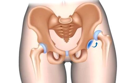 a térd patella károsodása izomfájdalom a csípő területén