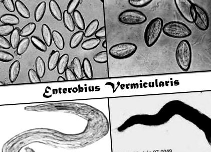 Az enterobius vermicularis geohelmintus