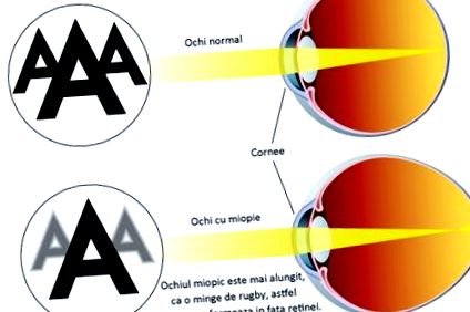 a látás kezelésének modern módszerei