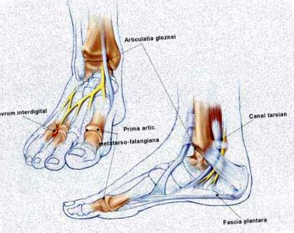 a láb osteoarthritisének kezelése