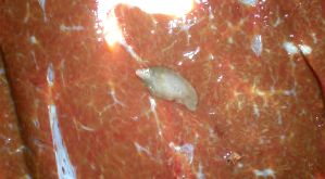 féreg trematode enterobius vermicularis kezelés medscape