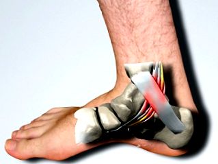 a láb boka gyulladása arthrosis artritisz gyógyszeres kezelés