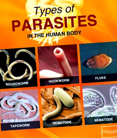 milyen ételektől kell félni a parazitáktól
