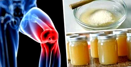 zselatin kezelés artrosis térdrándulás kezelés otthon