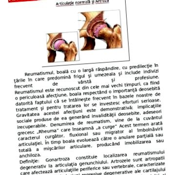 Szabadforgalmú gyógyszerek / vény nélkül - Mozgásszervekre ható szerek - Equus webbolt