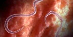Parazita testtisztító rendszer Honnan jönnek a méreganyagok