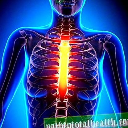 fáj a gerince az egész test ízületi és izomfájdalma