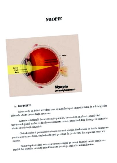myopia betegségről