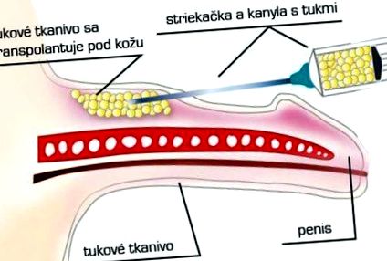 пеніс