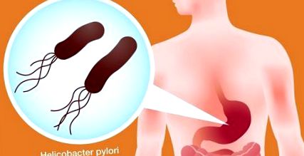 pylori