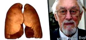 tüdőbetegségben légszomj