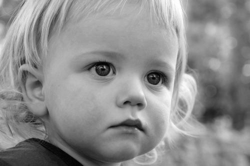 Алергія на щоках у дитини - у грудних дітей, ніж вилікувати, ніж мазати, місячну дитину дитини