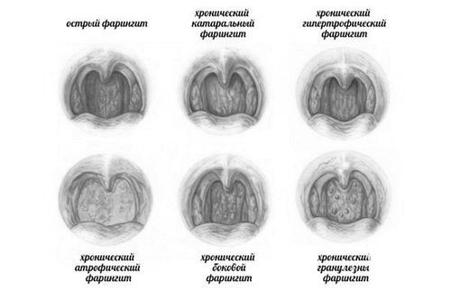 лікування