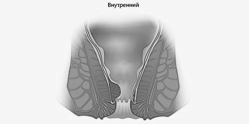 виліз