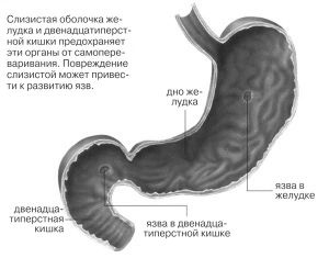 як лікувати ерозію шлунка народними засобами