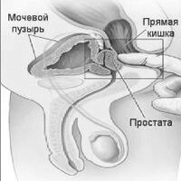 як лікувати кишкову трихомонаду