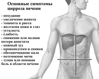 як лікувати цироз печінки