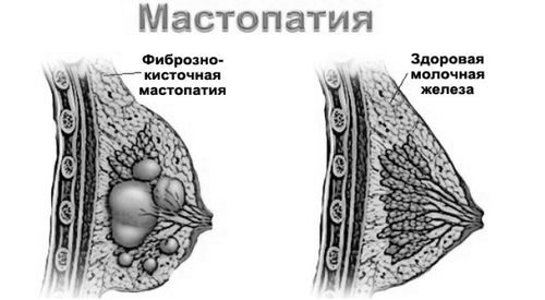 лікувати