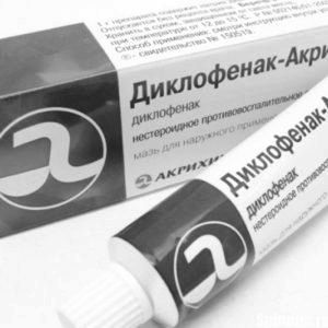 Лікування радикуліту медикаментозно: препарати і терапія при радикуліті терапія