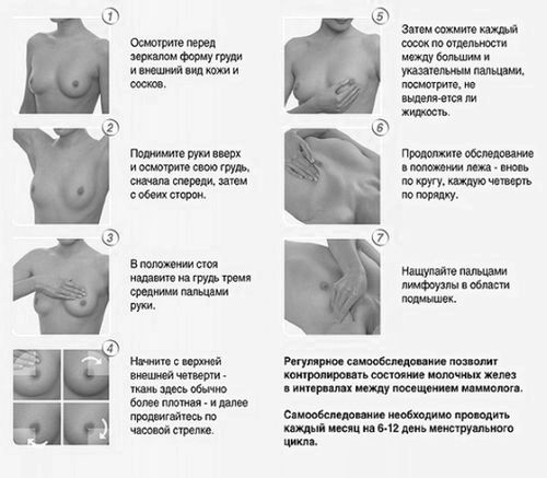 Мастопатія молочної залози: що це таке, як лікувати фіброаденоматозом грудей у жінок, які... як вилікувати мастопатію будинку