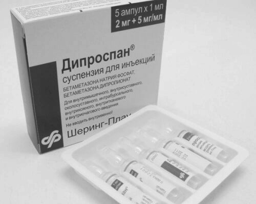 Медикаментозне лікування остеохондрозу шийного відділу хребта медикаментозне