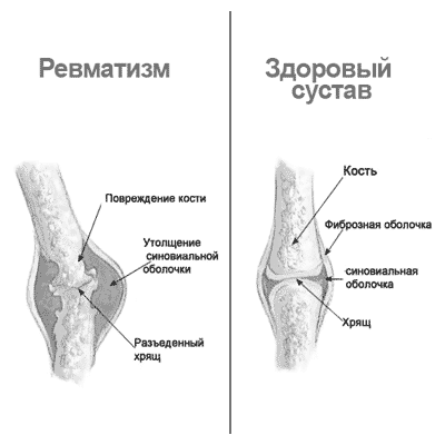 засобами