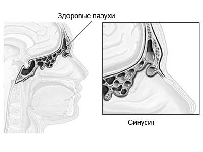 причини