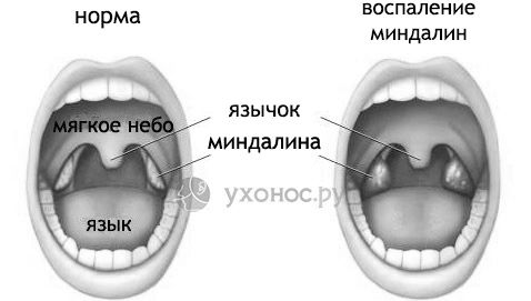 мигдалини