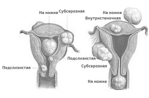 виділення