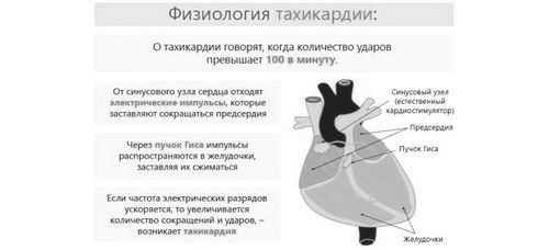 що робити при тахікардії в домашніх умовах