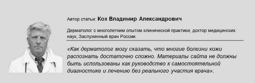 Сверблячка в інтимній зоні у жінок з виділеннями білого кольору: причини і лікування сверблячка