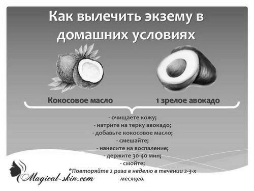 Алергічна екзема на руках і ногах алергічна