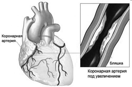 причини