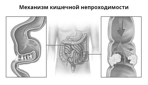 тягне