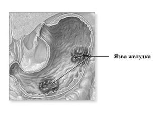 позбутися