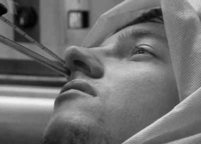 Кіста в носовій пазусі: лікування без операції, симптоми і наслідки лікування